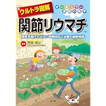 Amazon.co.jp: ウルトラ図解 関節リウマチ: 病気を進行させない早期